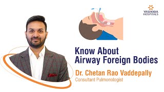 Know About Airway Foreign Bodies | Yashoda Hospitals Hyderabad