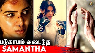 Shocking! ரத்த காயங்களுடன் நடிகை Samantha | Shooting Spot | Citadel