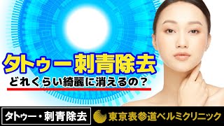 【最新】刺青除去レーザーなら東京表参道BeLumiクリニック。