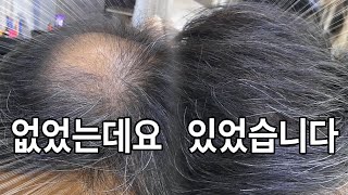 [Korean Master] 탈모인들의 희망, 가발 없이도 풍성해질 수 있는 증모술 명인ㅣHair loss hopes, can be enriched without wigs