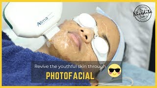 Photofacial treatment for Skin Lightening \u0026 Skin whitening