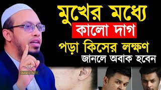 মুখের মধ্যে কালো দাগ পড়া কিসের লক্ষণ জানলে অবাক হবেন  ! আহমাদুল্লাহ