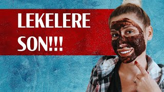 LEKE GİDERİCİ MASKE❗️❗️