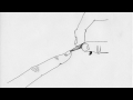 Leech Under Nail animation