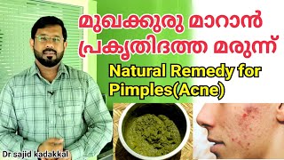 How to Remove Pimples(Acne) at Home, മുഖക്കുരു മാറാൻ ഫലപ്രദമായ പ്രകൃതിദത്ത മരുന്ന്,