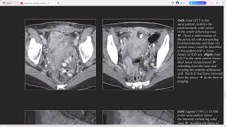 GYNAE DIAGNOSTIC IMAGING