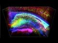 New Technologies to Explore the Brain