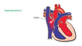 Atrial septal defect (ASD)