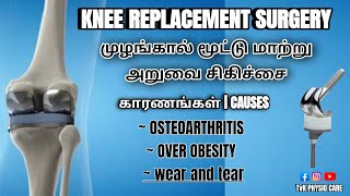 Knee replacement surgery | முழங்கால் மூட்டு மாற்று அறுவை சிகிச்சை  | காரணங்கள் | #kneereplacemeant