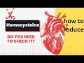 HOMOCYSTEINE: WHEN TO CHECK IT | HOW TO REDUCE HOMOCYSTEINE LEVELS | HOMOCYSTEINE BLOOD TEST