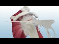 MEDHOLD double row rotator cuff repair using genesys crossft and poplok