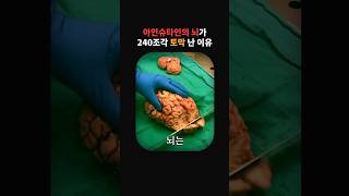 아인슈타인의 뇌를 240조각 토막 낸 미친 의사