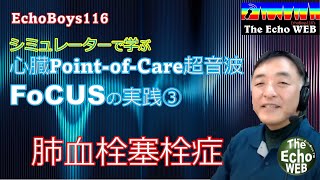 心臓Point-of-Care超音波（FoCUS）の実践③　肺血栓塞栓症