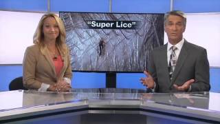 Super Lice