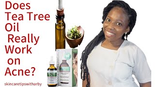 Does Tea Tree Oil Really Work on Acne? |Acne treatment |Clear skin