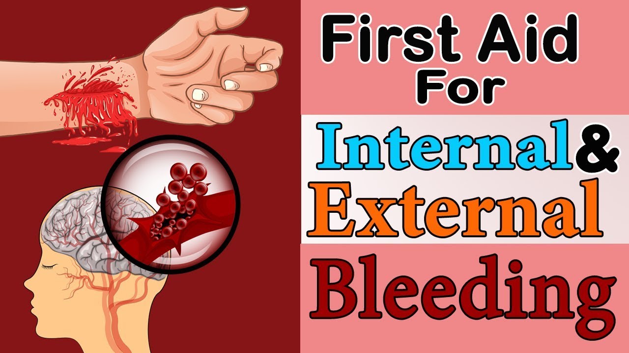 First Aid For External & Internal Bleeding | Great Wall Corporate ...