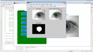 Iris segmentation matlab code projects