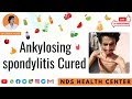 Ankylosing spondylitis & other 17 diseases  By Dr. Zarna Patel (NDS) | New Diet System