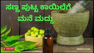 ಸಣ್ಣ ಪುಟ್ಟ ಕಾಯಿಲೆಗೆ ಮನೆಮದ್ದು | Health Care and Tips