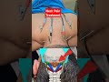 neck pain treatment shorts shortvideo short viralvideo viralshorts trending youtube india