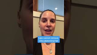 Weight Loss or Liposuction? | Greer Plastic Surgery