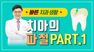 치아의파절 1편 - 성누가병원 건강플러스 tv 37화