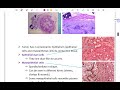 oral pathology 2 lecture 8