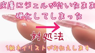 リクエスト編☆皮膚にジェルが付いたまま硬化してしまったときの対処法☆初心者さん向け/nailstepsリップ