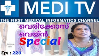 Ep 222_Ayurveda for Vericose Vein | വെരിക്കോസ് വെയ്ൻ | Dr.Sreela Vipin | MEDI TV - 2019