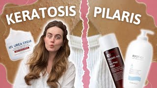 Goodbye Strawberry Legs \u0026 Keratosis Pilaris aka. Chicken Skin: Tips That Work! ✅