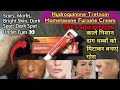 Hydroquinone Tretnoin Mometasone Furoate Cream || AAKARSHAN Cream || Use and side effects | in hindi