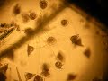 mikrogeo video 12 vorticella1