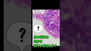 何かに似ている病理組織像 ⑰ #dermatopathology #皮膚科専門医