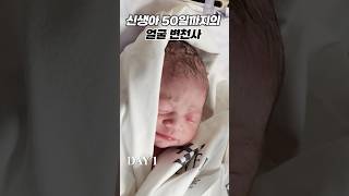 신생아 50일 까지의 얼굴 변화