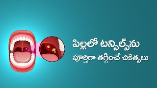 Causes and  Cures for Tonsillitis and Adenoiditis in Children in Telugu | టాన్సిల్స్ వాపు