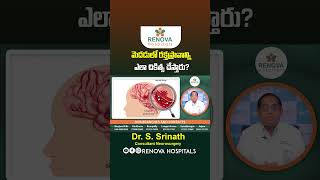 Treatment for Brain Hemorrhage Stroke | Brain Stroke Paralysis Treatment | #shorts #ytshorts