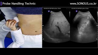 초음파 강의_초음파 프로브 핸들링 테크닉 교육_ SONOUS  대표강사: 장경미
