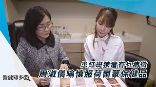 【醫健知多D】患紅斑狼瘡有乜病徵 周淑儀喻慎服荷爾蒙保健品