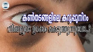 IADVL KERALA ചർമ്മാരോഗ്യ൦ -(Under Eye Darkness) കൺതടങ്ങളിലെ കറുപ്പുനിറം