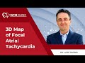 3D map of focal Atrial Tachycardia