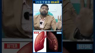 நுரையீரல் பாதிப்பு ஏற்பட்டால் இதெல்லாம் பண்ணுங்க | Dr Sabari About Lung Cleansing | #shorts