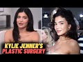 Kylie Jenner's Plastic Surgery: Fans Spot New Clues!