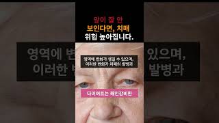 앞이 잘 안보인다면 치매위험 높아집니다