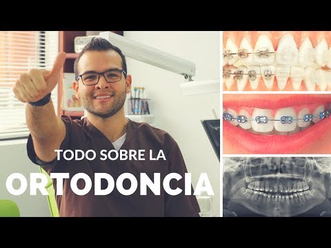 Lo Que Debes Saber De La Ortodoncia ¿Que Es La Ortodoncia?