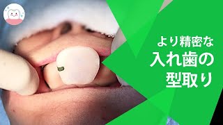 総入れ歯の精密な型取りで快適な入れ歯ライフに‼️ Take Impression of Your Full Dentures!!