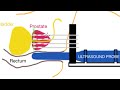 MedPhys - 26.2 - Brachytherapy Applications: Prostate brachytherapy.