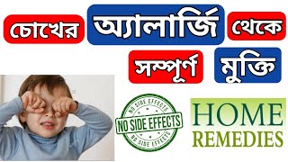 Eye allergy home remedies | চোখের অ্যালার্জি দূর করার ঘরোয়া উপায় |  চোখ@YourstudyEducation