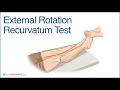 External Rotation Recurvatum Test