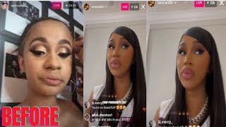 Cardi B talks about plastic surgery she had on her face gives advices  on plasti