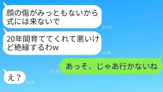 20年間育てた義理の母が顔に傷があるからと結婚式に出席させない娘「絶対来ないでw」→母が言われた通りに式を欠席した結果がwww